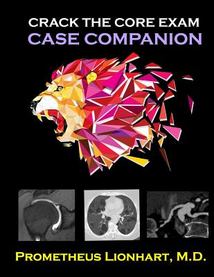 Crack the CORE Exam - Case Companion - Lionhart M D, Prometheus