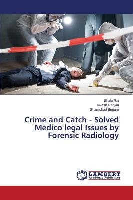 Crime and Catch - Solved Medico legal Issues by Forensic Radiology - Rai Shalu, and Ranjan Vikash, and Begum Shamshad