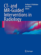 CT- and MR-Guided Interventions in Radiology