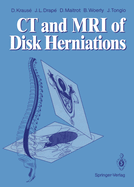 CT and MRI of Disk Herniations