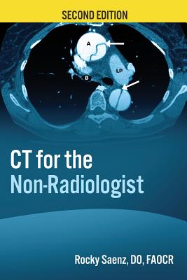 CT for the Non-Radiologist: The Essential CT Study Guide - Saenz, Rocky, Dr.