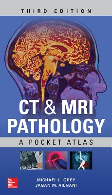 CT & MRI Pathology: A Pocket Atlas, Third Edition - Grey, Michael L, and Ailinani, Jagan Mohan