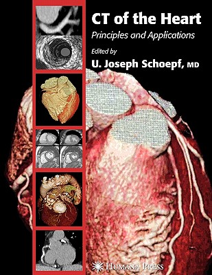 CT of the Heart: Principles and Applications - Schoepf, U. Joseph (Editor)