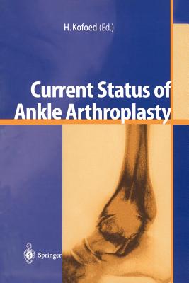 Current Status of Ankle Arthroplasty - Kofoed, Hakon (Editor)