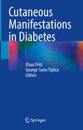 Cutaneous Manifestations in Diabetes