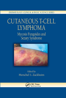 Cutaneous T-Cell Lymphoma: Mycosis Fungoides and Sezary Syndrome - Zackheim, Herschel S. (Editor)