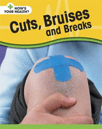 Cuts, Bruises and Breaks