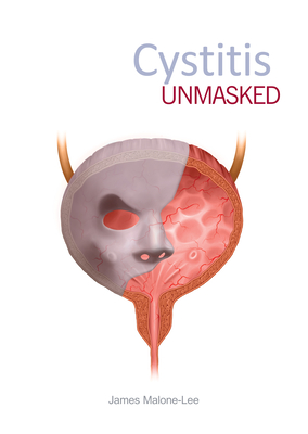 Cystitis Unmasked - Malone-Lee, James (Editor)