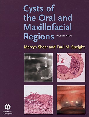 Cysts of the Oral and Maxillofacial Regions - Shear, Mervyn, and Speight, Paul M