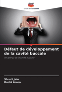 D?faut de d?veloppement de la cavit? buccale