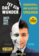 Das Ist Ein Wunder Sagte Mein Arzt: Haarverlust Und Alopezie Umkehren