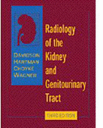 Davidson's Radiology of the Kidney and Genitourinary Tract - Davidson, Alan J, and Hartman, David S, MD, and Choyke, Peter L, MD