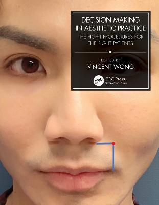 Decision Making in Aesthetic Practice: The Right Procedures for the Right Patients - Wong, Vincent (Editor)