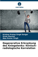 Degenerative Erkrankung des Kniegelenks: Klinisch-radiologische Korrelation