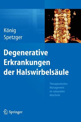 Degenerative Erkrankungen Der Halswirbelsule: Therapeutisches Management Im Subaxialen Abschnitt - Knig, Stefan Alexander, and Spetzger, Uwe