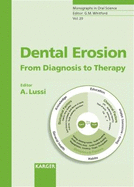 Dental Erosion: From Diagnosis to Therapy