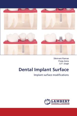 Dental Implant Surface - Raman Shrimant, and Arora Pooja, and Singh S P
