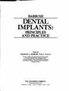 Dental Implants: Principles & Practice