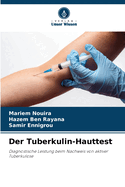 Der Tuberkulin-Hauttest