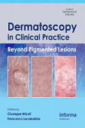 Dermatoscopy in Clinical Practice: Beyond Pigmented Lesions