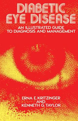 Diabetic Eye Disease: An Illustrated Guide to Diagnosis and Management - Kritzinger, E E, and Taylor, K G