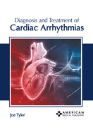 Diagnosis and Treatment of Cardiac Arrhythmias