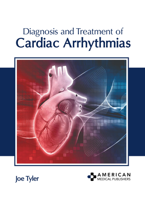 Diagnosis and Treatment of Cardiac Arrhythmias - Tyler, Joe (Editor)