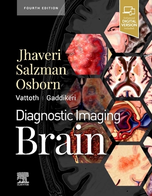 Diagnostic Imaging: Brain - Jhaveri, Miral D.
