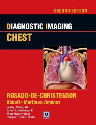 Diagnostic Imaging: Chest - Rosado-De-Christenson, Melissa L