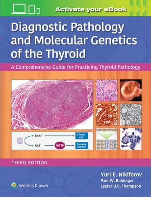 Diagnostic Pathology and Molecular Genetics of the Thyroid: A Comprehensive Guide for Practicing Thyroid Pathology - Nikiforov, Yuri E, MD, PhD, and Biddinger, Paul W, MD, and Thompson, Lester D R, Dr., MD, Fascp