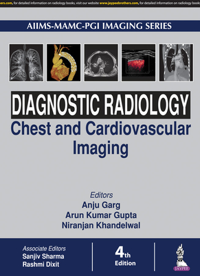 Diagnostic Radiology: Chest and Cardiovascular Imaging - Garg, Anu, and Gupta, Arun Kumar, and Khandelwal, Niranjan