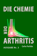 Die Chemie Der Arthritis: Warum Menschen Kein Fleisch Essen Sollten