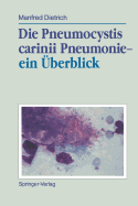 Die Pneumocystis Carinii Pneumonie-- Ein berblick