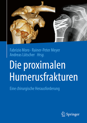 Die Proximalen Humerusfrakturen: Eine Chirurgische Herausforderung - Moro, Fabrizio (Editor), and Meyer, Rainer-Peter (Editor), and L?tscher, Andreas (Editor)