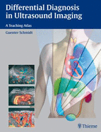 Differential Diagnosis in Ultrasound Imaging: A Teaching Atlas - Schmidt, Gunter, and Schmidt, Guenter