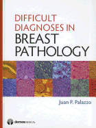 Difficult Diagnoses in Breast Pathology