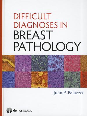 Difficult Diagnoses in Breast Pathology - Palazzo, Juan