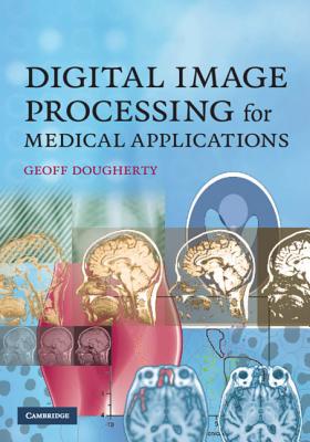 Digital Image Processing for Medical Applications - Dougherty, Geoff, Professor