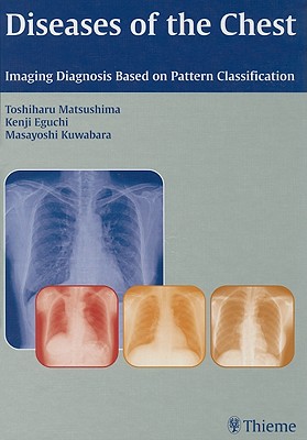 Diseases of the Chest: Imaging Diagnosis Based on Pattern Classification - Matsushima, Toshiharu, and Eguchi, Kenji, and Kuwabara, Masayoshi