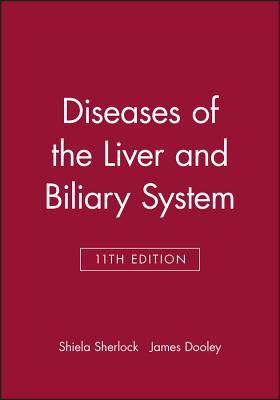 Diseases of the Liver and Biliary System - Sherlock, Shiela, and Dooley, James