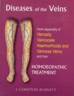 Diseases of the Veins: More Especilly of Venosity, Varicocele, Hemmorrhoids & Varicose Veins & Their Homoeopathic Treatment