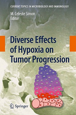 Diverse Effects of Hypoxia on Tumor Progression - Simon, M Celeste (Editor)