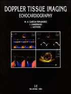 Doppler Tissue Imaging: Echocardiography