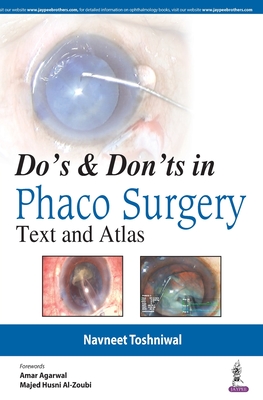 Do's & Dont's in Phaco Surgery: Text and Atlas - Toshniwal, Navneet