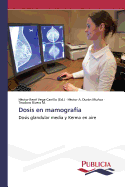 Dosis En Mamografia