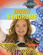 Down Syndrome