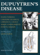 Dupuytren's Disease - Badalmente, Marie A, and Hurst, Lawrence C, and LeClercq, Caroline, MD