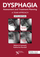 Dysphagia Assessment and Treatment Planning: A Team Approach