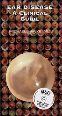 Ear Disease: A Clinical Guide - Hawke, Michael