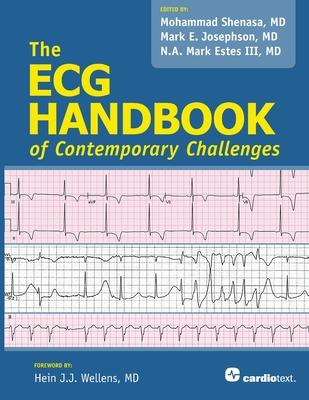 ECG Handbook of Contemporary Challenges - Shenasa, Mohammad, and Josephson, Mark E., and Estes, N. A. Mark, III